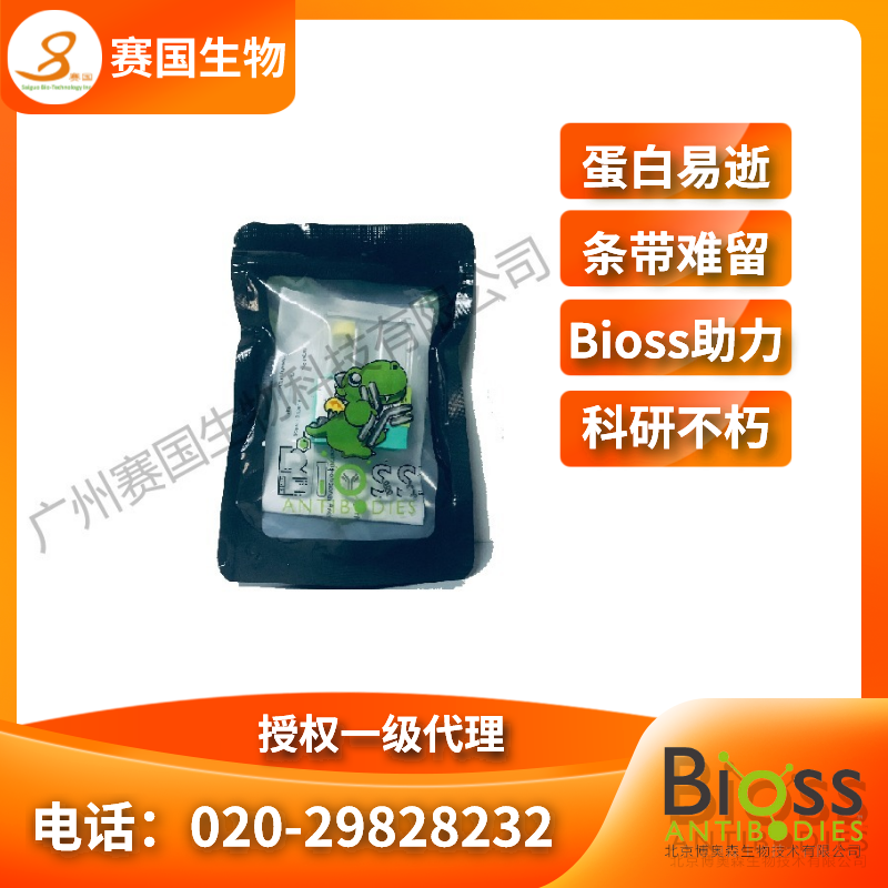 核心結合因子α1/成骨特異性轉錄因子/Cbfα1抗體 | RabbitAnti-RUNX2 antibody 核心結合因子α1/成骨特異性轉錄因子/Cbfα1抗體 | RabbitAnti-RUNX2 antibody